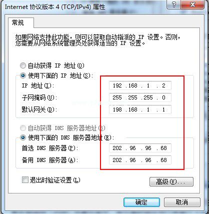 怎么设置本地连接ip