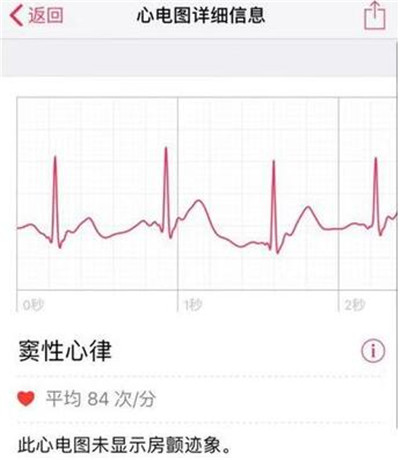 Apple  Watch怎么查看心电图