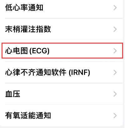 Apple  Watch怎么查看心电图